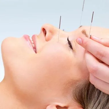 5 Acupuncture Points for Anxiety — What Your Practitioner Targets and Why