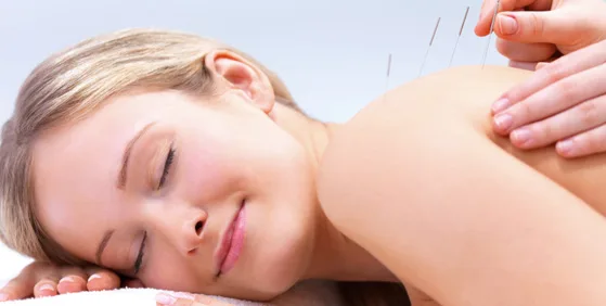 Calm patient receiving acupuncture for anxiety in Toronto